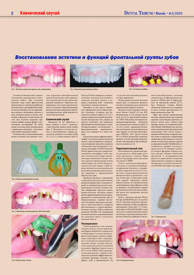 PDF Превью