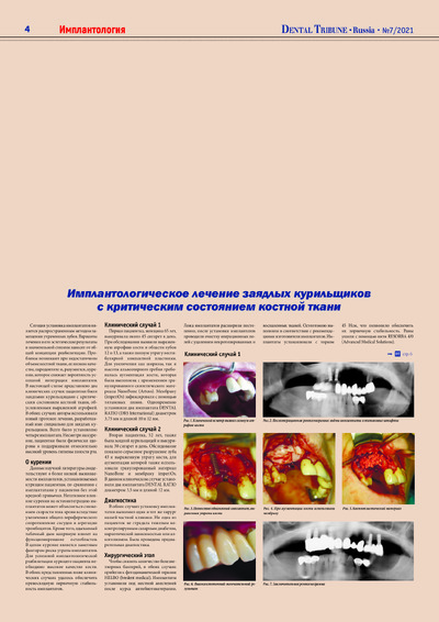 PDF Превью