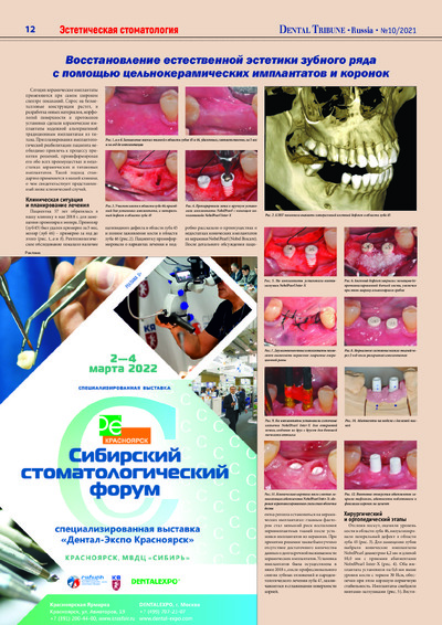 PDF Превью